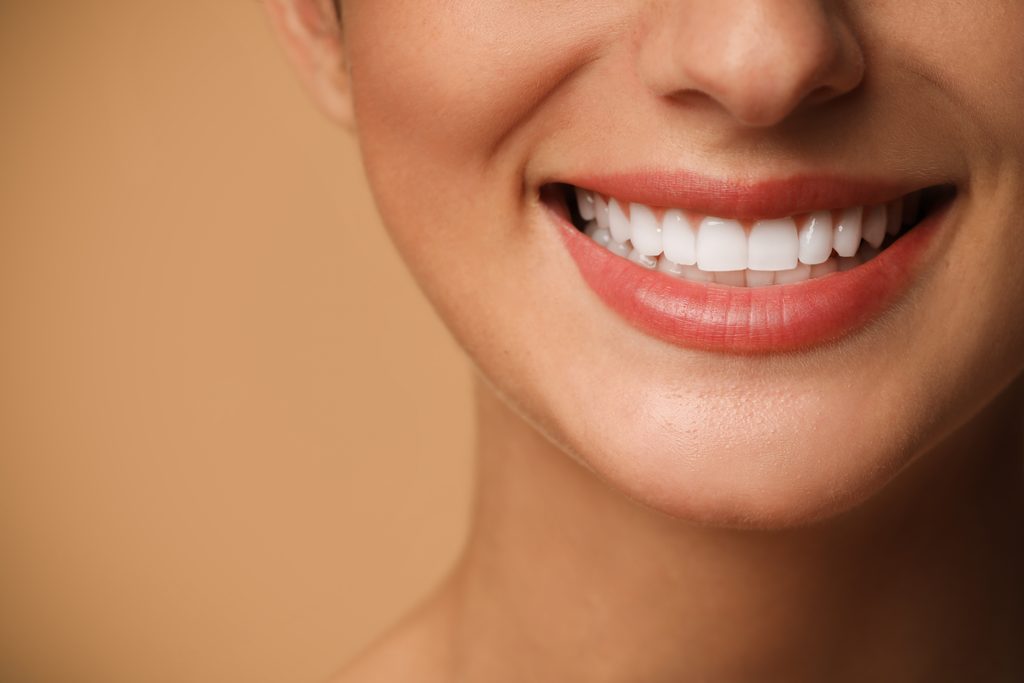 smile makeover
