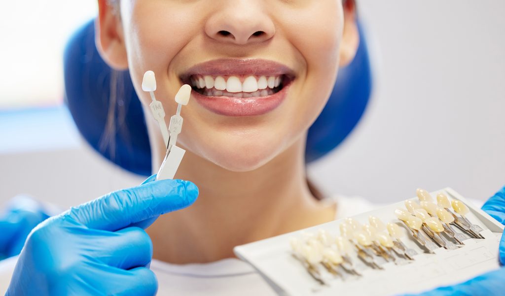 Dental Veneers

